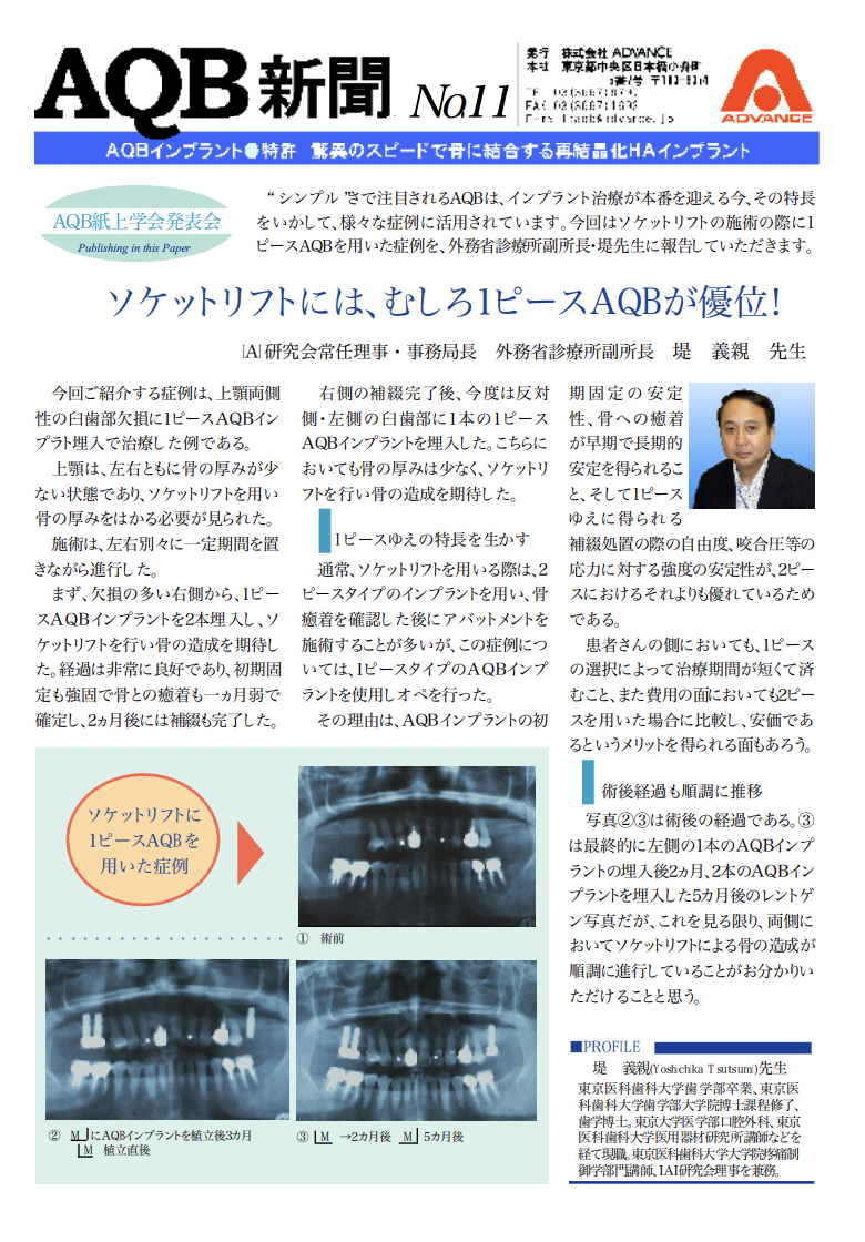 プレビュー