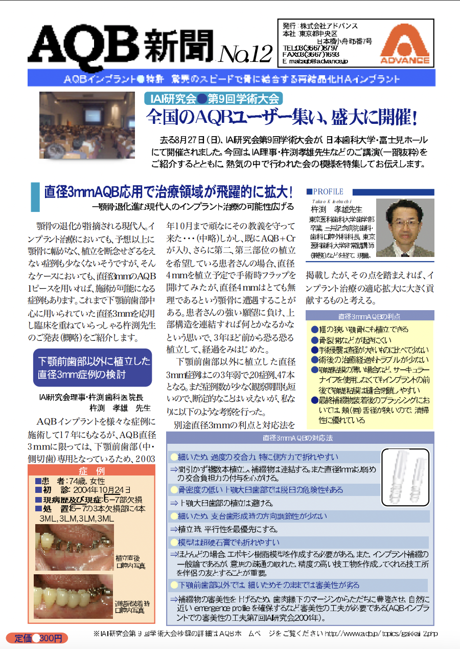 プレビュー