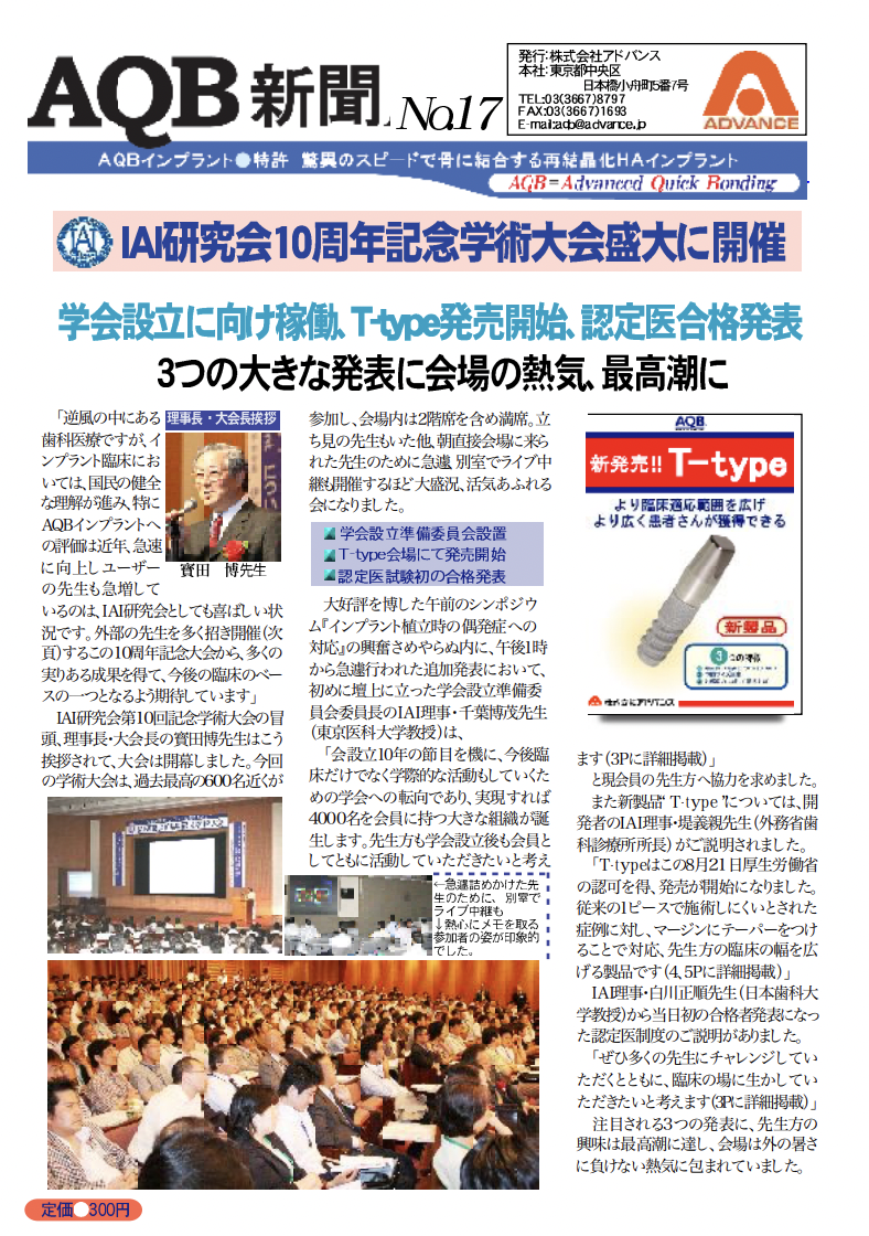プレビュー